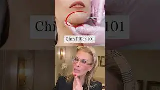 Chin Filler 101 #beauty #filler #botox