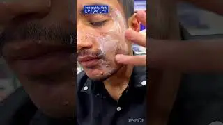Glow & Clean Anti Acne Cream Amazing #ameenbeautytips @GlowAndCleanByAmeen
