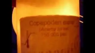 Hatching Acartia tonsa Copepod eggs part 1