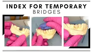 DENTAL MOCK UP // TEMPORARY BRIDGES // PART 1 // Dental Assistant