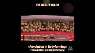 EM Beautyslim&copy; - &laquo;REVOLUTION IN BODYFORMING&raquo;
