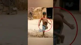 Особенные дети с редкими телами в мире 😲