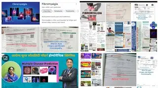 Fibromyalgia Cured  Patient Treatment at Aarogya Super Speciality Modern Homeopathic Clinic Indore