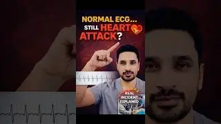 &ldquo;Normal ECG&hellip; Still Heart Attack? | Real Incident Explained&rdquo;