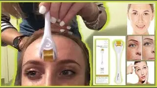 Dermarolling Fine Lines On The Forehead
