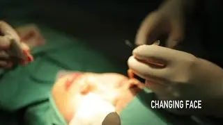 Changing Face: China&rsquo;s cosmetic surgery industry