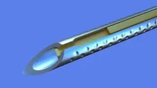 EchoTip&reg; Ultra Fiducial Needle Animation