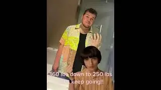 I lost over 100 pounds with Gastric Sleeve!