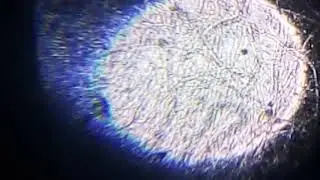 Bluegreen mold (400 magnification)