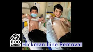 Boo Banter Cancer Journey Pt 5 - Hickman Line Removal