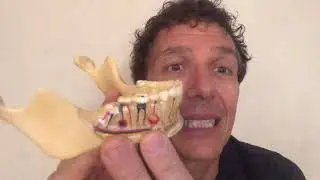 Granulomi, Denti del giudizo e TAC