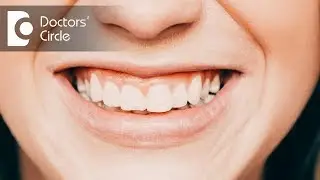 How do I know that I grind my teeth in the night? - Dr. Raju Srinivas