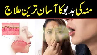What Causes Bad Breath? Diagnosis and treatment | Munh ki Badboo ka Asan Ilaj