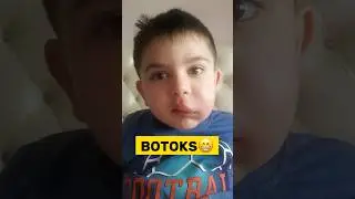 ARI SOKARSA NE OLUR 😁🐝 9 SENEDE 3 FOTO