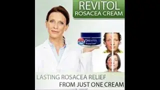 Amber's Beauty Chair - A Natural Treatment For Acne Rosacea Rosacea Diaries  - Amber's Beauty Chair