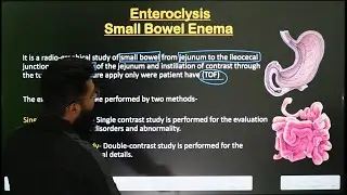 Small Bowel Enema || Enteroclysis Procedure || Part-1 || In Hindi || Radiological Procedure ||