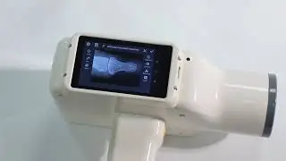 [Wireless Connectivity and Functionality Demonstration] Dental X-Ray Machine+ iRay Dental Sensor