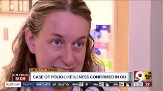 Cases of polio-like illness confirmed in Tri-State