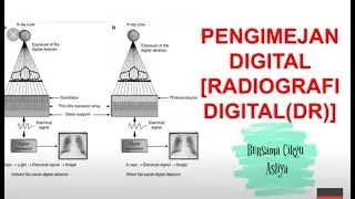 Radiography : Digital Imaging [Digital Radiography (DR)]