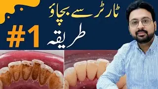 The #1 Remedy to Prevent Tartar at Home | Dentist Explains
