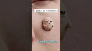 Existem esses 4 tipos de pele (oleosa, seca, mista ou sens&iacute;vel) qual &eacute; a sua? j&aacute; cuidou dela hoje ?