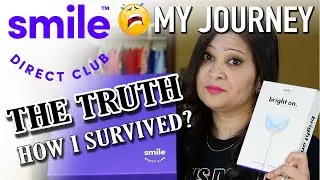 SMILE DIRECT CLUB REVIEW | THE TRUTH ABOUT MY JOURNEY | Process and Cost