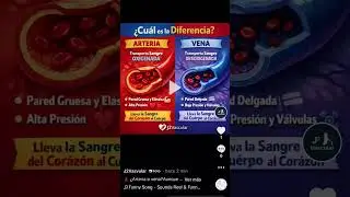 arteria y vena. #j2vascular #hospital #cirugia #medico #enarm #angio #doctor