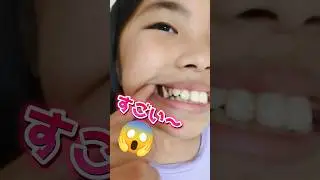 【抜歯】ヤバいぐらいに大きい歯🦷ガブリチュウで抜いてみた😱 #抜歯 #乳歯