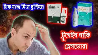 Trugen Spray vs SPlendora Spray Review | কোনটা ভালো চুলের জন্য? | Hair Loss Treatment বাংলা রিভিউ
