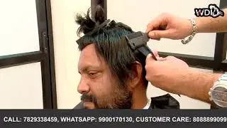Best Non surgical hair Replacement in India by  WDI