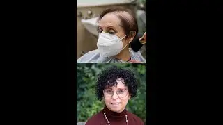 Pr&oacute;tesis capilar para mujer
