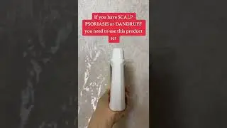 Scalp Psoriasis Treatment