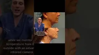 Nonsurgical Skin Tightening of the Face and Neck
