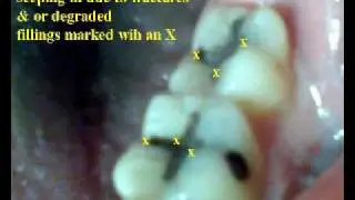 Q Dental Jeffrey Earle