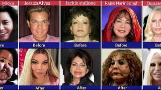 Shocking celebrity plastic surgery Disasters || Before and After