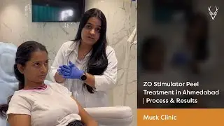 ZO Stimulator Peel Treatment in Ahmedabad, India | Process & Results