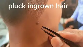 PLUCK INGROWN HAIR and pull out grey hairs asmr