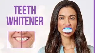 5 Best Teeth Whitening Products on Amazon | Teeth Whiteners that Actually Works