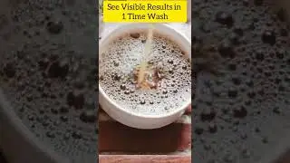 Try This Viral Shampoo Hack 💯 | 😍 Amazing Results Must Try ✌🏻#shorts #viralhack #diy #youtubeindia
