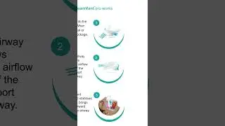 DreamVent - Anti Snoring Device