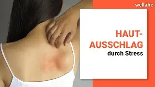 Hautauschlag durch Stress (Ursachen, Symptome, Bek&auml;mpfung)