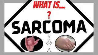 SARCOMA? What is it?