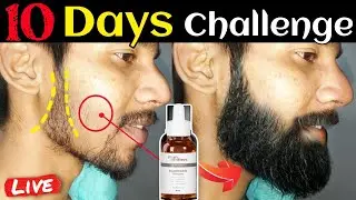 Man Matters Beard Growth Serum After 15 Days Review |Best Beard Growth Oil For Patchy Beard in India