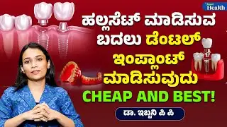 How Much Do Dental Implants Cost ಹಲ್ಲಸೆಟ್&zwnj; ಮಾಡಿಸುವ ಬದಲು ಡೆಂಟಲ್&zwnj; ಇಂಪ್ಲಾಂಟ್&zwnj; ಮಾಡಿಸುವುದು cheap and best