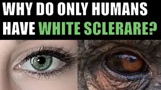 The Amazing Reason Why Humans Have White Sclerae!