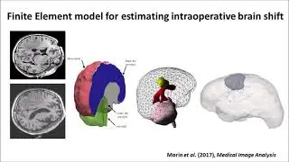 Research works from Yohan Payan and colleagues