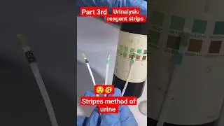 part3rd strips method of urine#test#shorts#viral#shortsvideo 🧪💦🤒