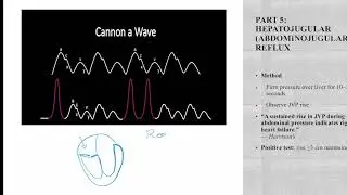 IM1- 14 &ndash; JUGULAR VENOUS PULSE Part 1-Demonstrate and measure jugular venous pressure#medical