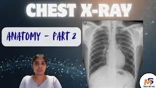Chest X-Ray Anatomy (Part 2)