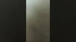 #Dr #CheckUp #Vagina #vaginacleansing #survival #pubic #pubiccleaning #thighs #naked